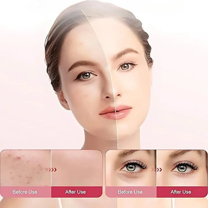 Painel de terapia com luz vermelha LumaDerm™